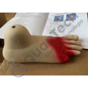 MODELO ANATOMICO DE PIE DIABÉTICO 1