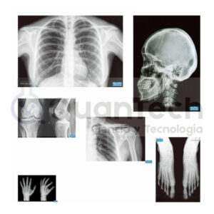 SET DE 6 RAYOS X DEL CUERPO HUMANO