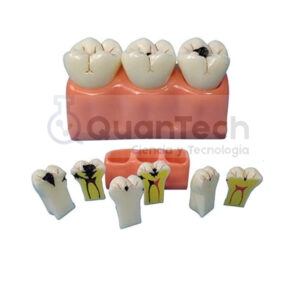 MODLEO DENTAL CON CARIES 7PCS